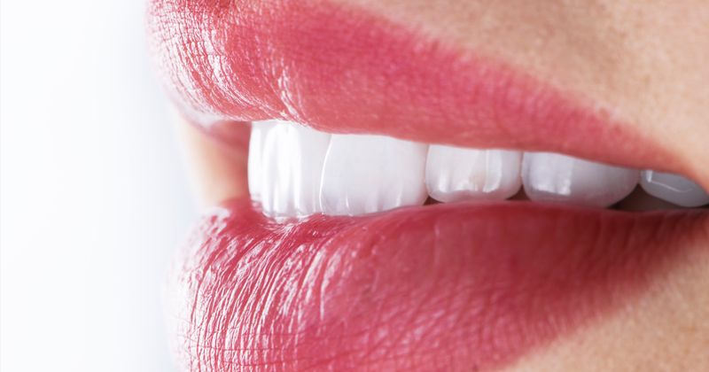 dernières avancées en matière d'implants dentaires